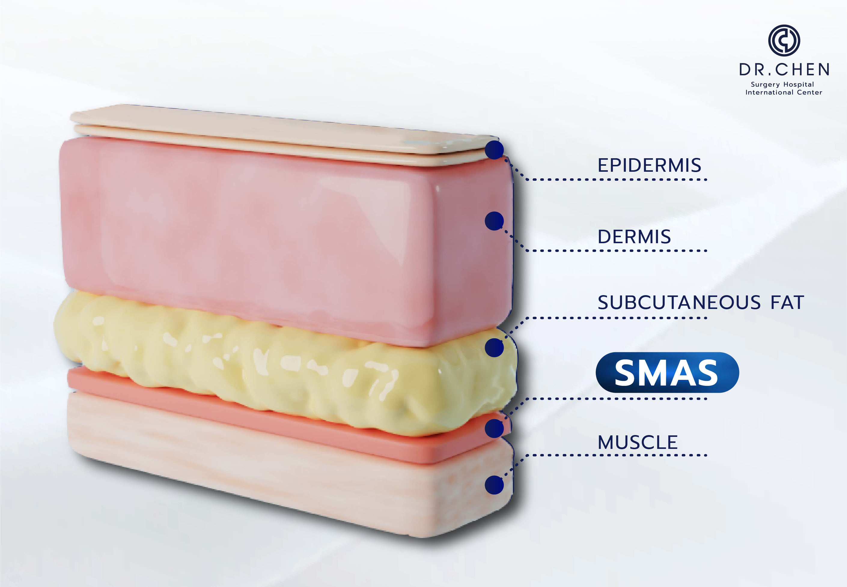 ชั้นผิวหนัง SMAS