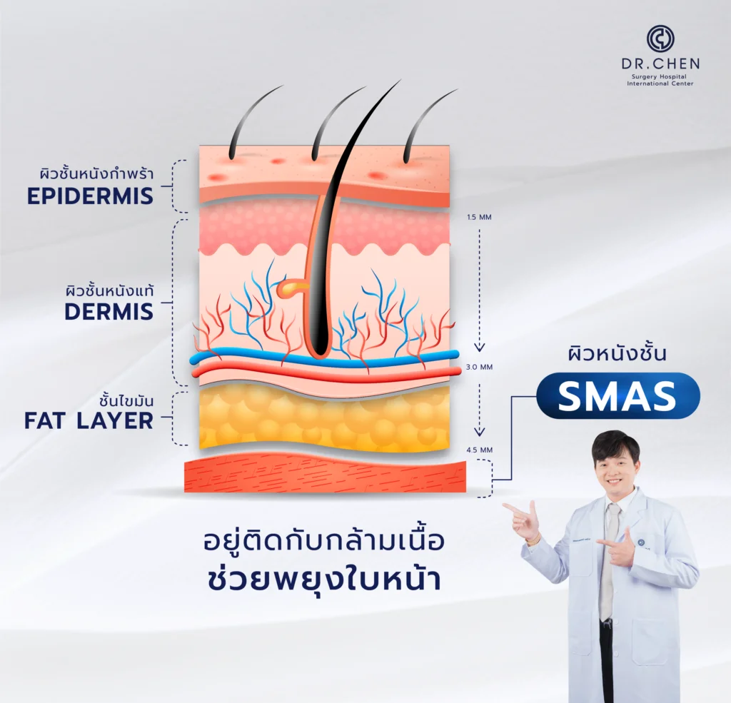 ชั้นผิวหนัง smas