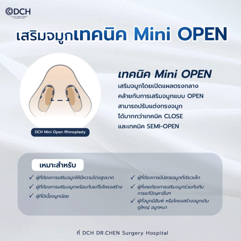 เสริมจมูกเทคนิค mini open