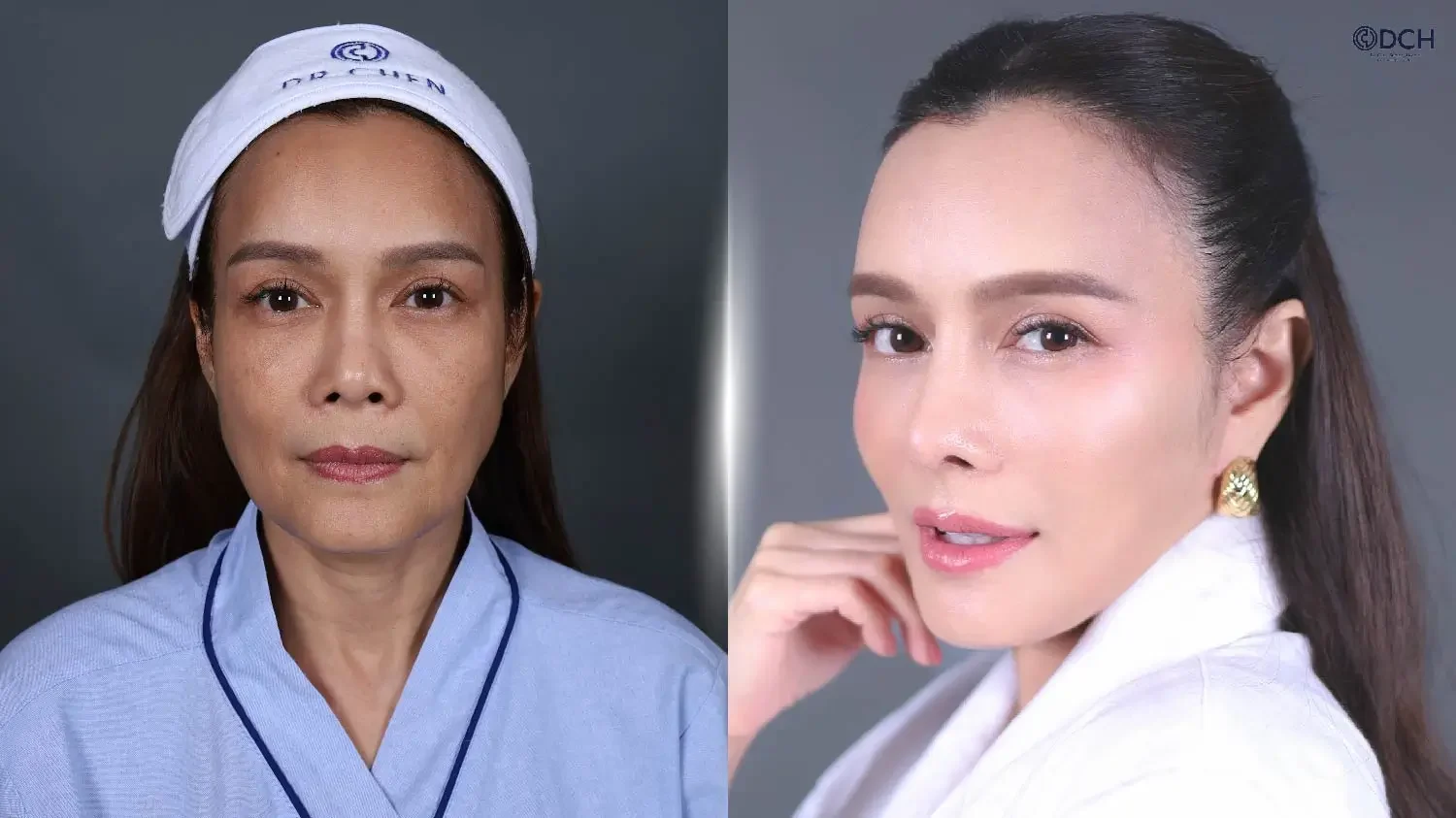 ดึงหน้า