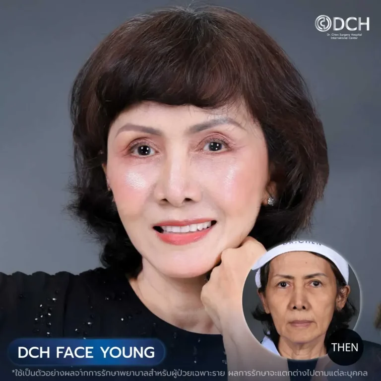 ศัลยกรรมดึงหน้า