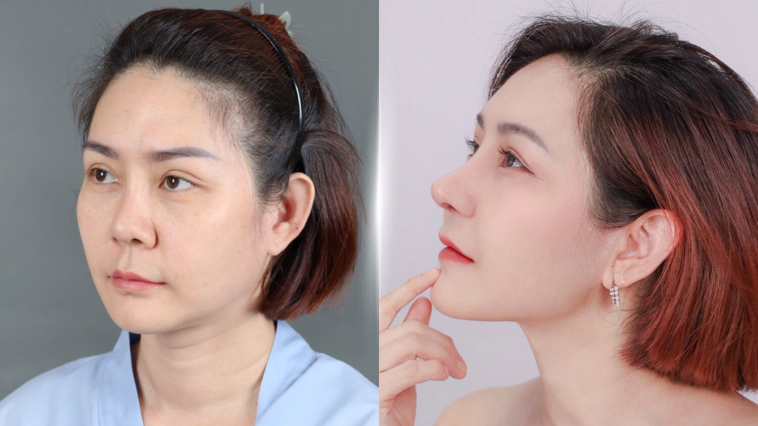 แก้จมูก