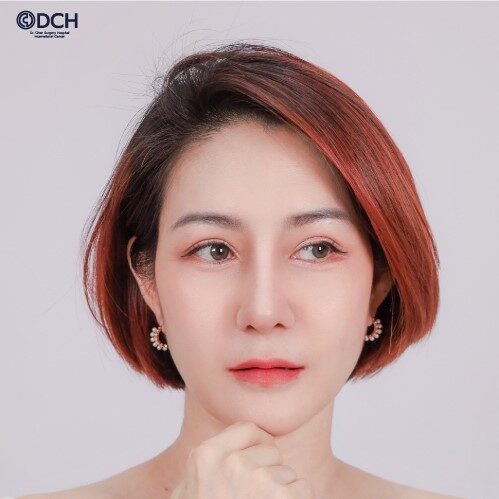 แก้จมูก