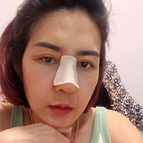 แก้จมูก