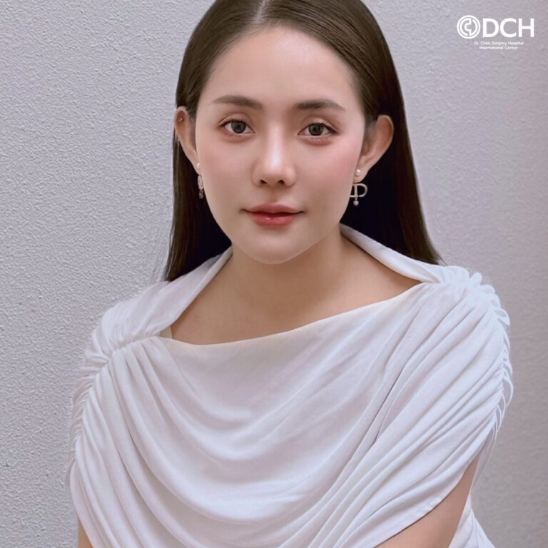 แก้จมูกที่ไหนดีคุณไวน์-หลังทำ2