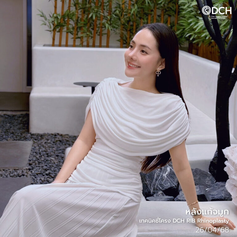 แก้จมูกที่ไหนดีคุณไวน์-หลังทำ3