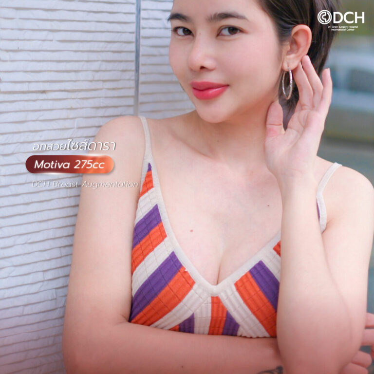 คุณนุกกี้แก้จมูก+เสริมหน้าอกหลังทำ-2