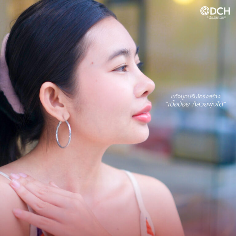 คุณนุกกี้แก้จมูก+เสริมหน้าอกหลังทำ-1