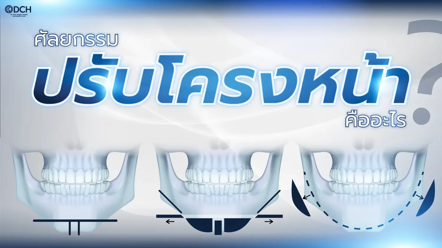 ปรับโครงหน้า