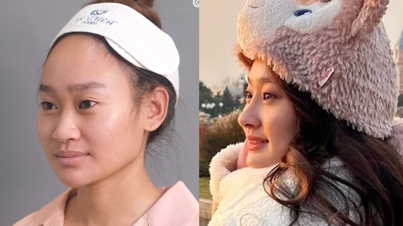 ปกคุณซูเจินเสริมจมูกที่ไหนดี