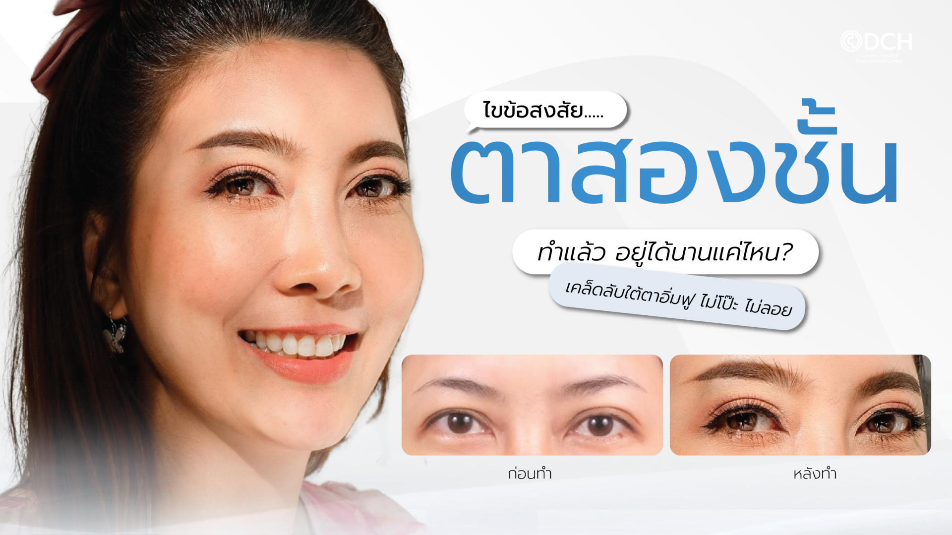 ไขข้อสงสัย ทำตาสองชั้นอยู่ได้นานแค่ไหน - DCH Hospital