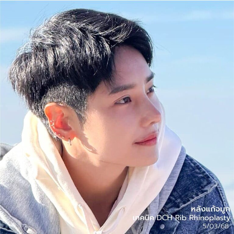 แก้จมูกคุณผึ้ง1