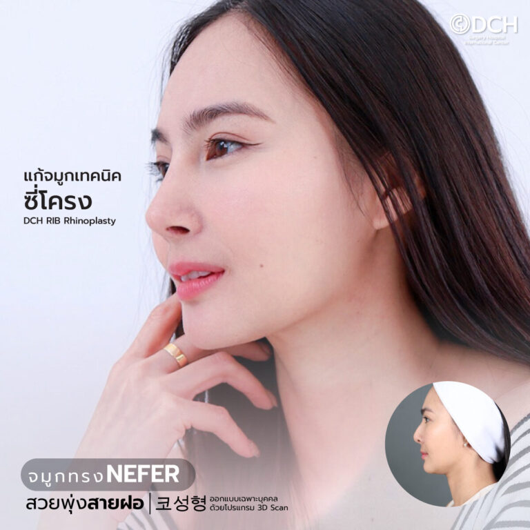 ทรงจมูก NEFER-2