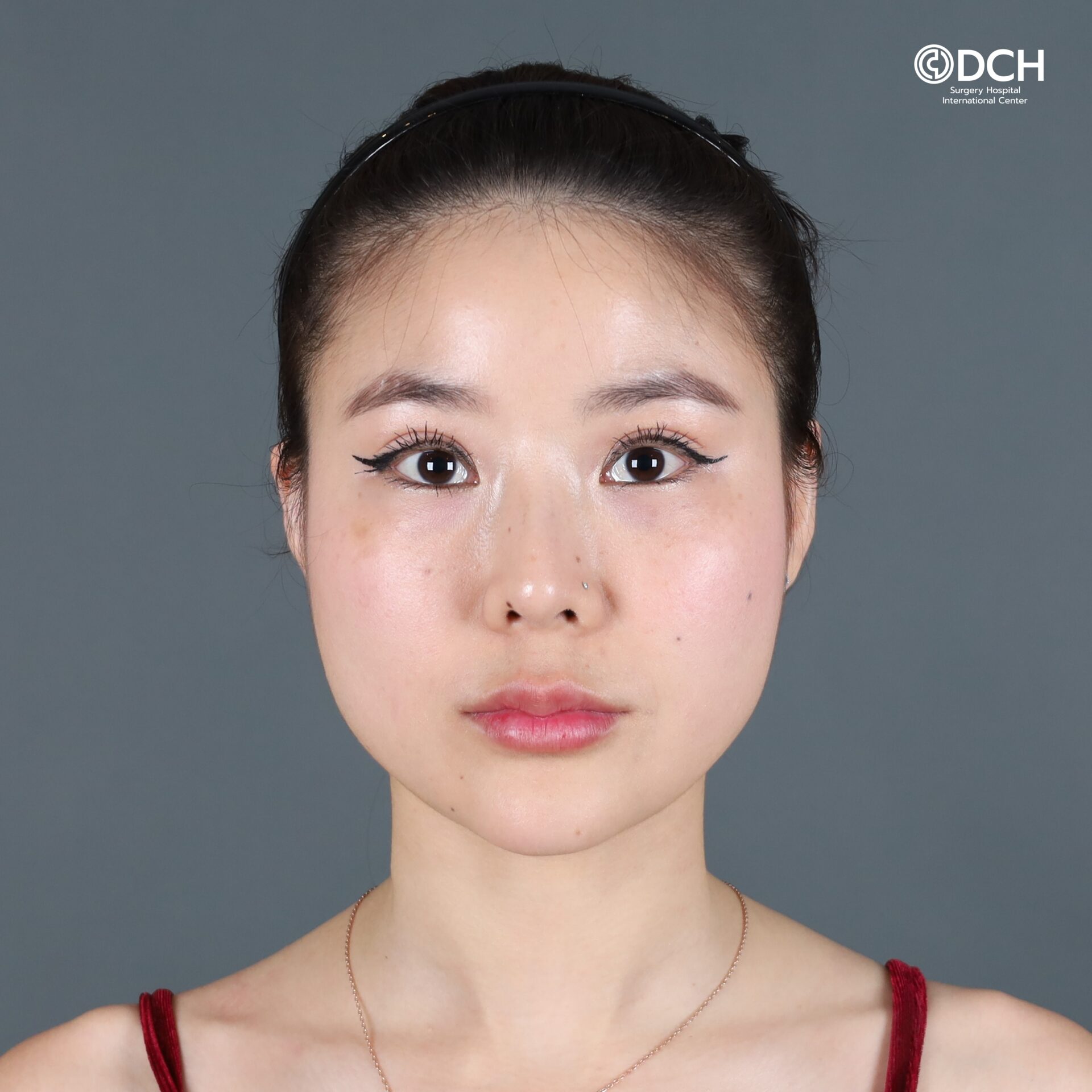 ปรับโครงหน้า