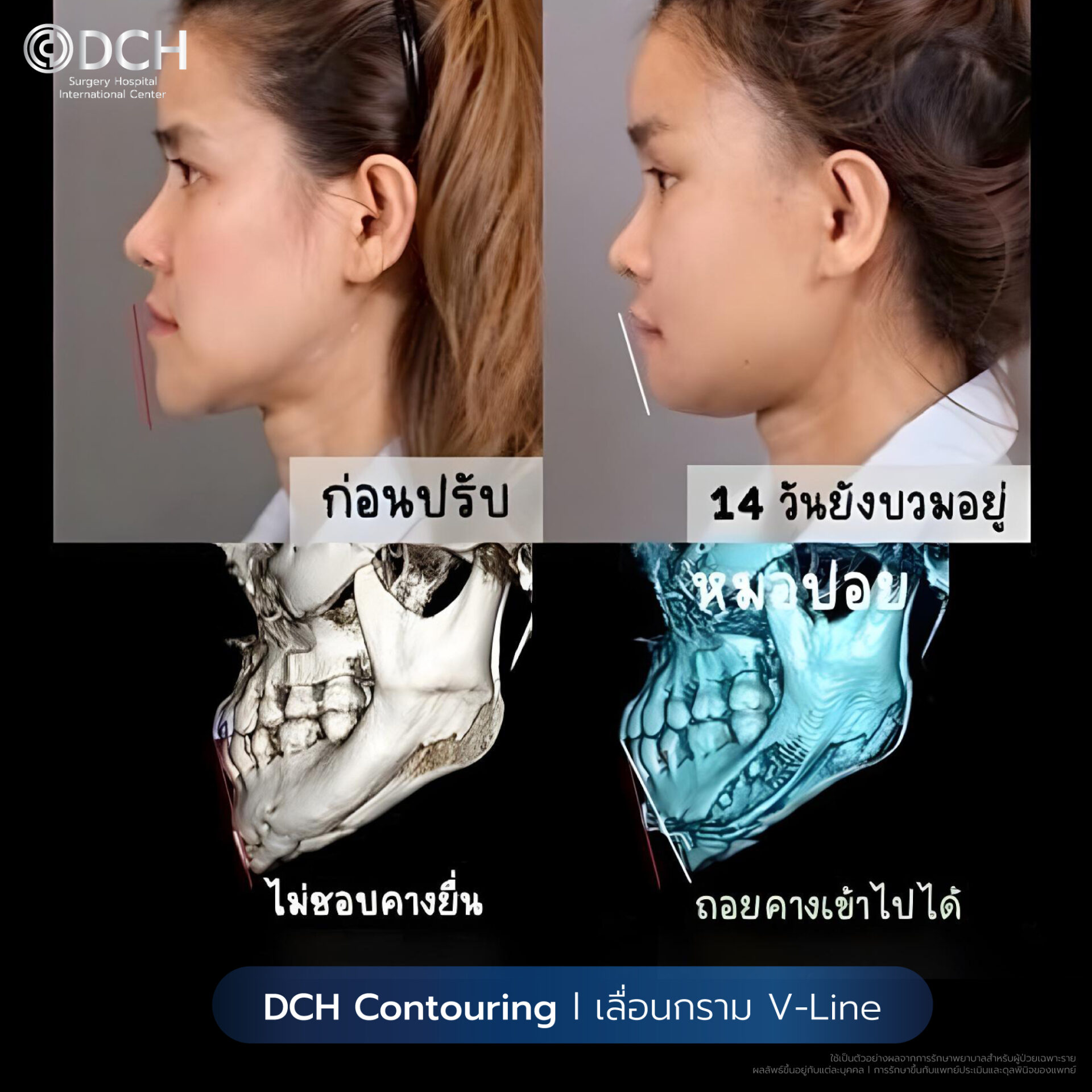 ไลฟ์สไตล์-คุณกิ๊ก-โครงหน้า05