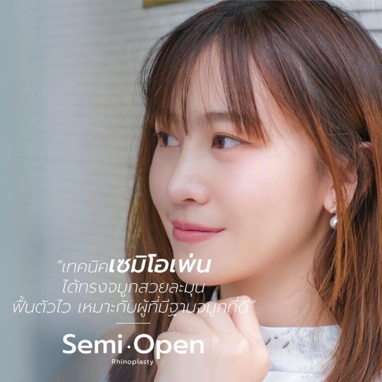 4เทคนิคศัลยกรรมจมูกสไตล์เกาหลี-3