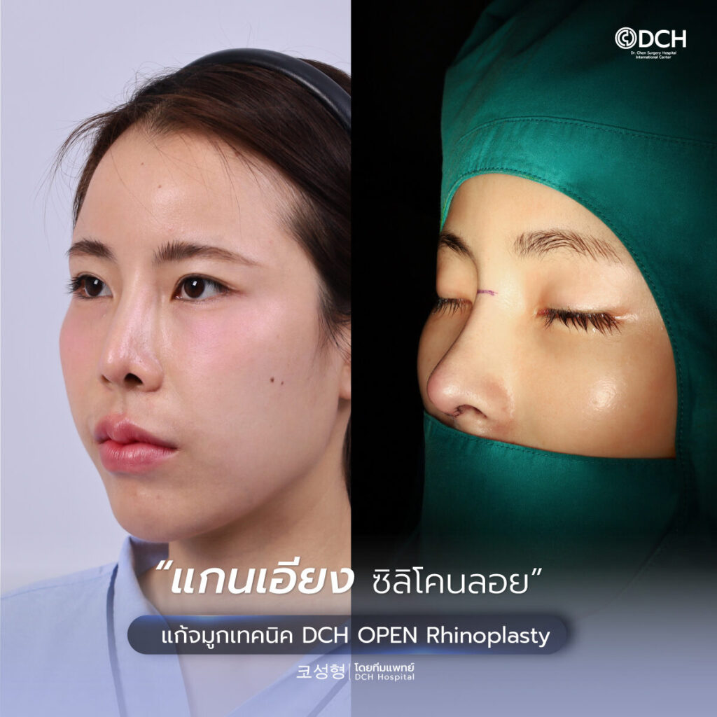 514314814_1306558104813080_1731572405434645680_n