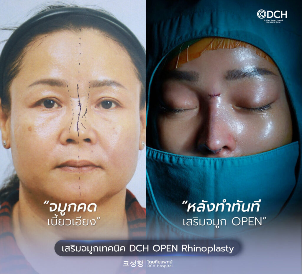 518416716_1306558854813005_4752026634947491959_n