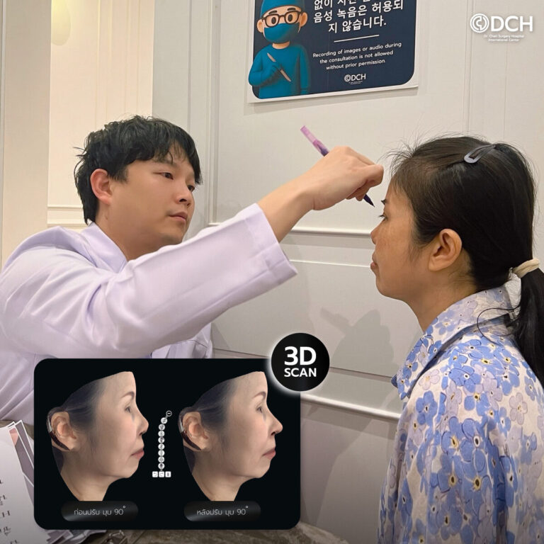 ก่อนแก้จมูกคุณอ้อย-2