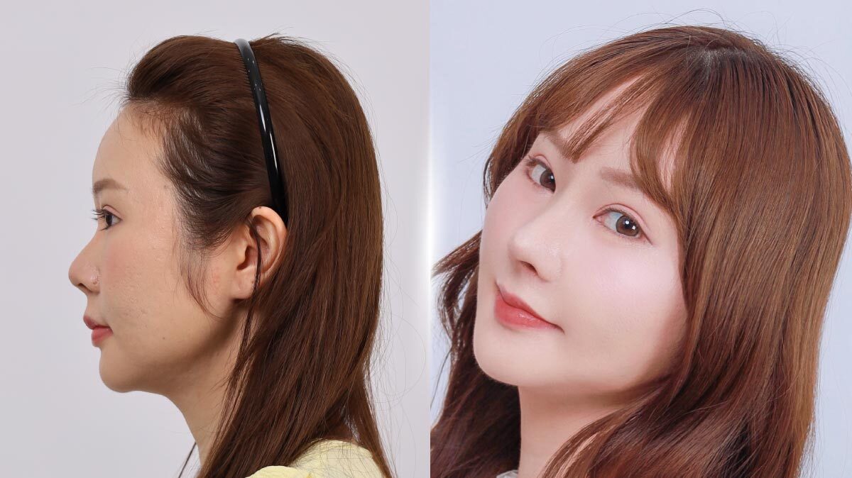 ปกบทความคุณลีออนแก้จมูก