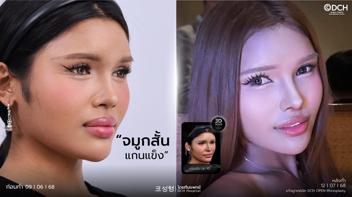 ปกบทความแก้จมูกคุณเซอร์เวย์