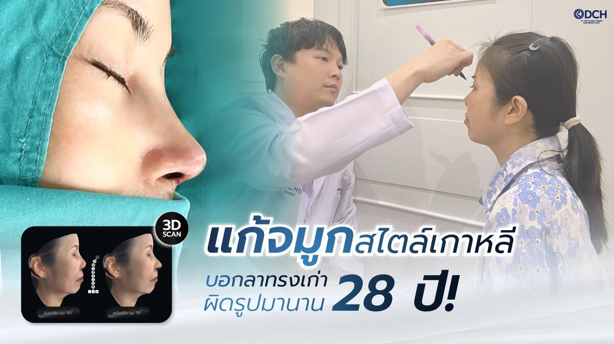 ปกบทความแก้จมูกสไตล์เกาหลีคุณอ้อยโอเพ่น