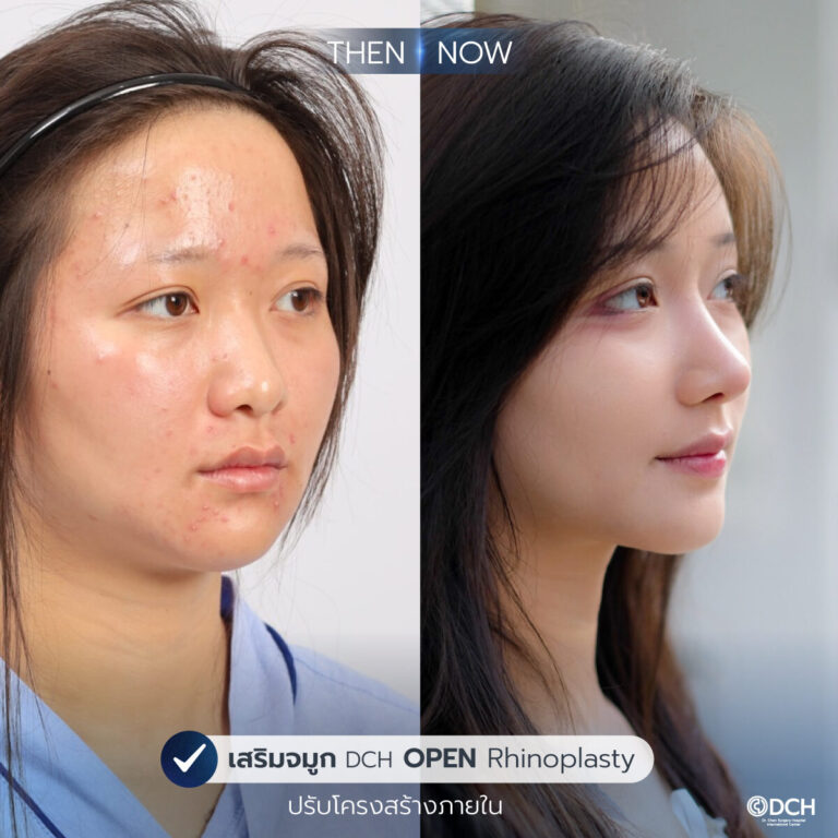 รีวิวจมูก-B-A-ใบเตย