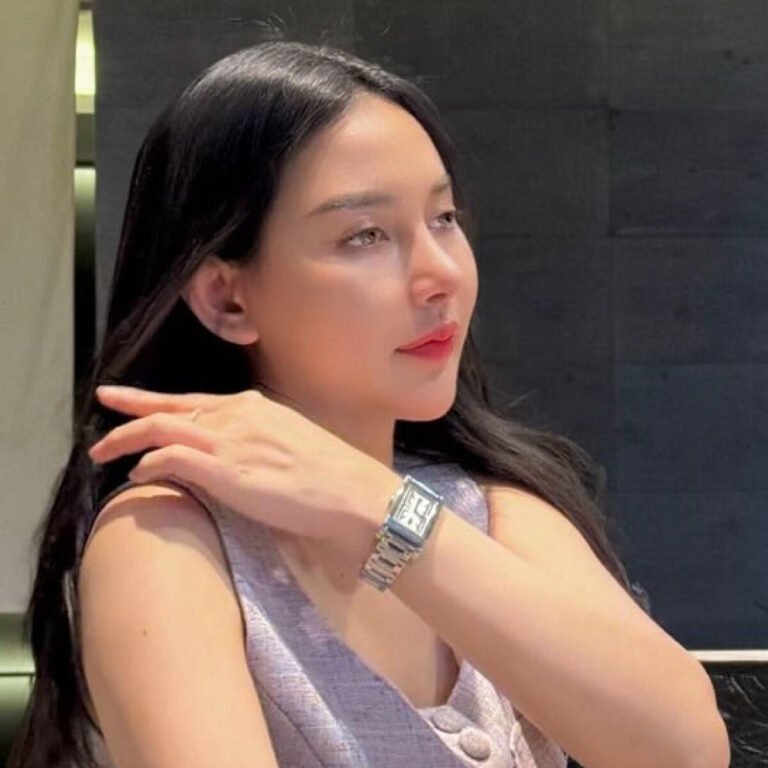 แก้จมูกโอเพ่น คุณกิ๊ฟ หลังทำ 4 เดือน-1