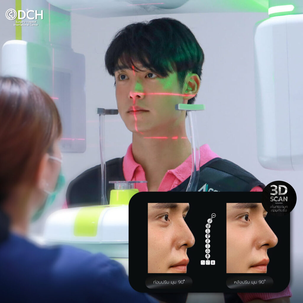 แก้จมูกโอเพ่น คุณฮิม 3d