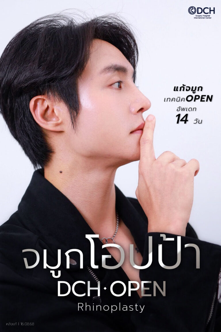 คุณฮิม 14 หลังแก้จมูก-1