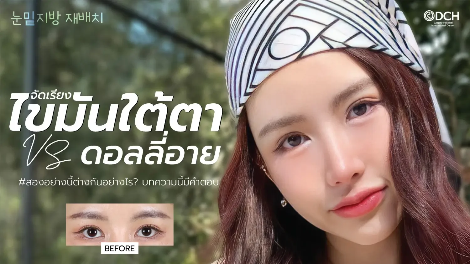 จัดเรียงไขมันใต้ตา