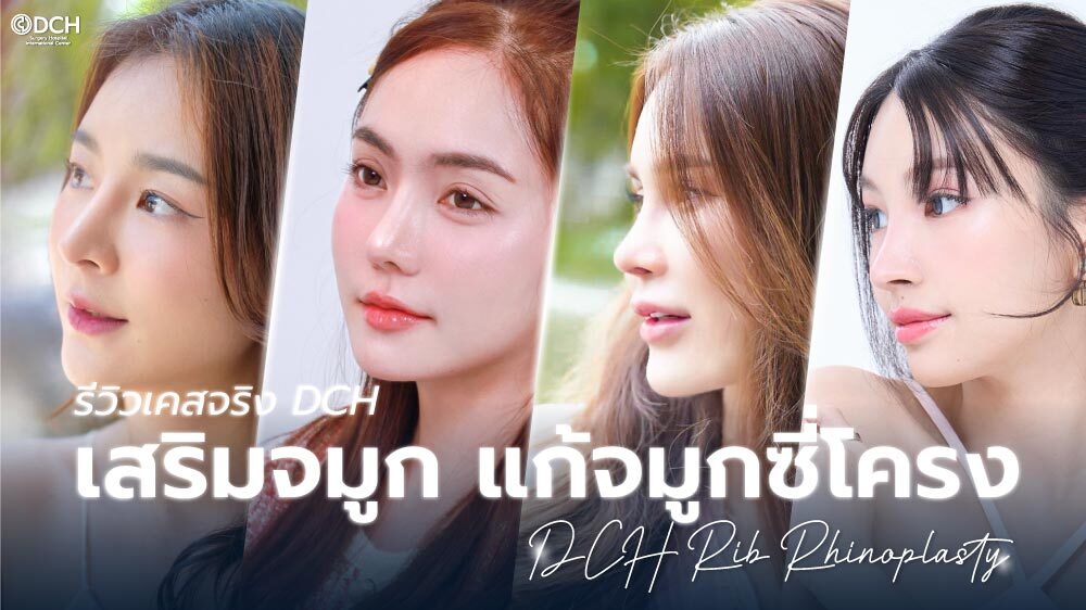 ปกบทความรีวิวเคสจริงเสริมจมูกแก้จมูกซี่โครง