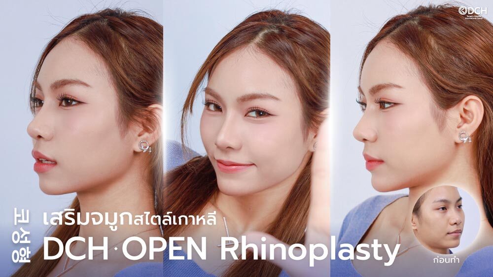 ปกบทความเสริมจมูกคุณอองออล