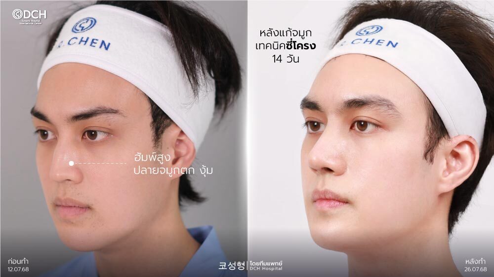 ปกบทความแก้จมูกคุณกอเกียร์