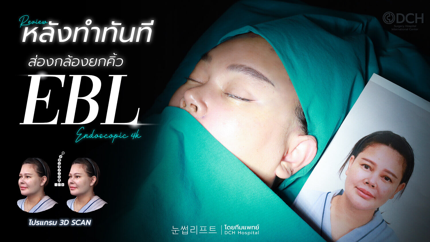 ยกคิ้ว EBL