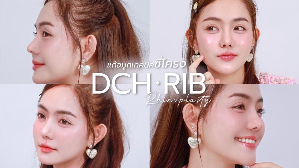 แก้จมูกคุณไวน์-4-เดือน