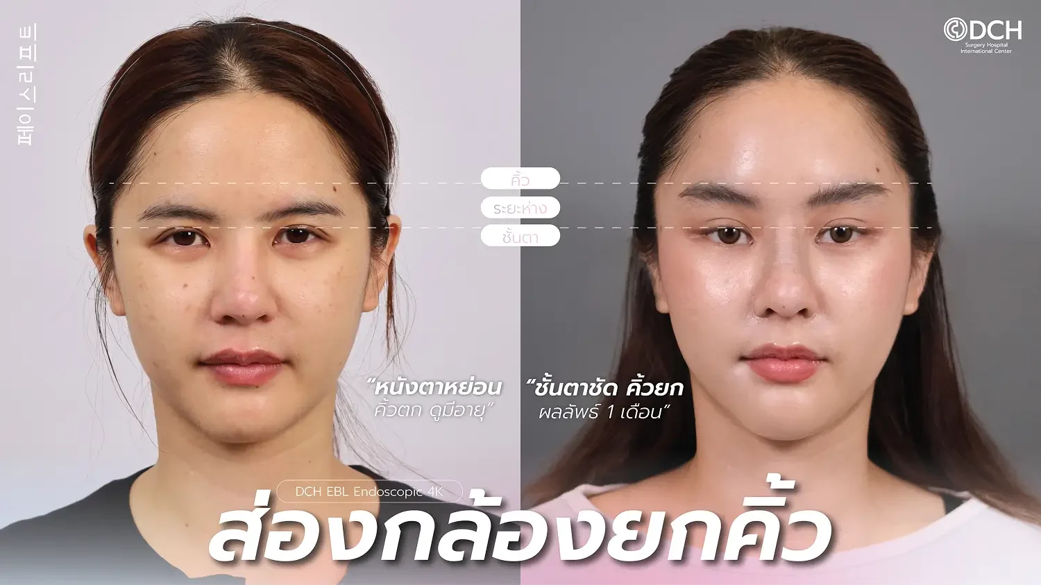 ยกคิ้ว EBL