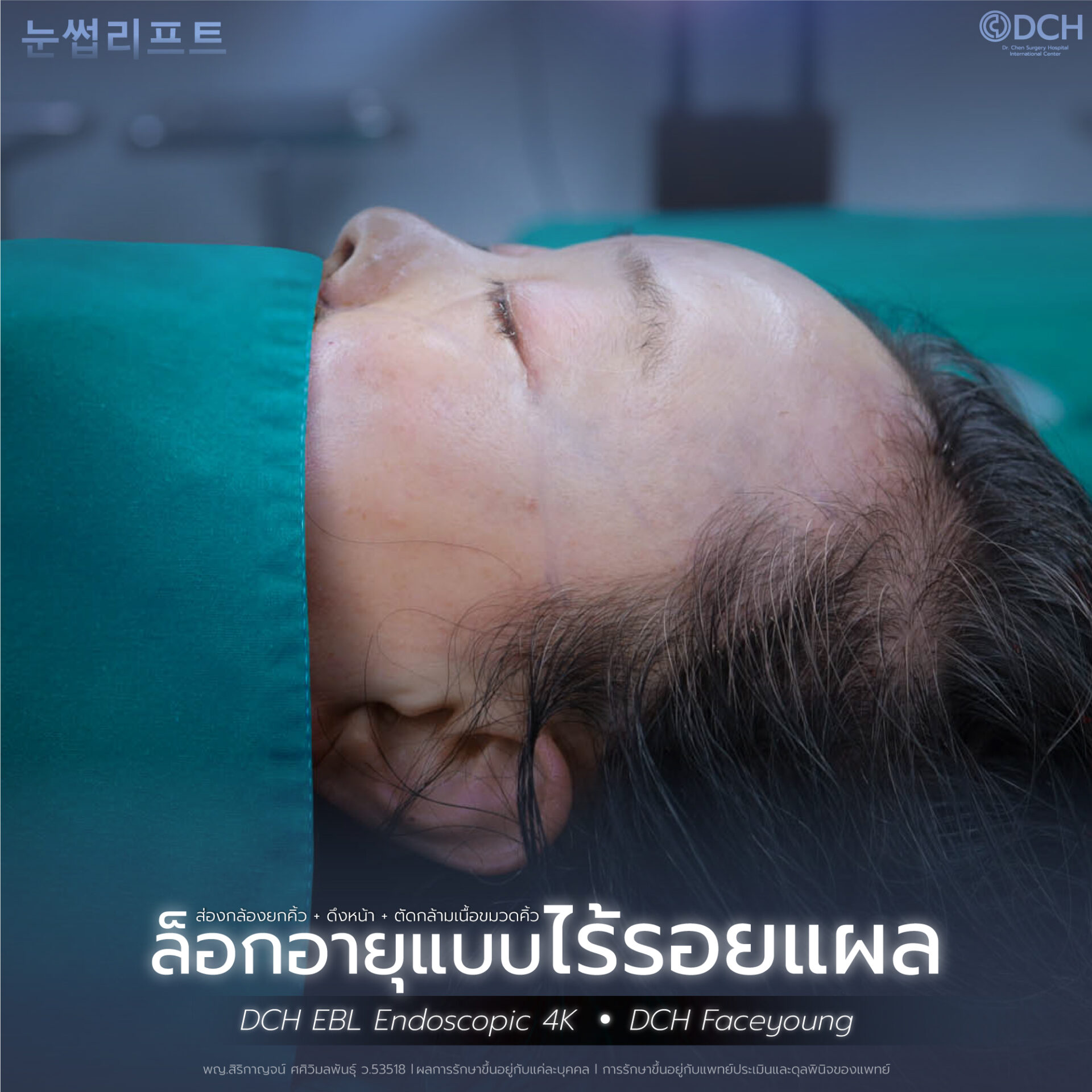 ดึงหน้า