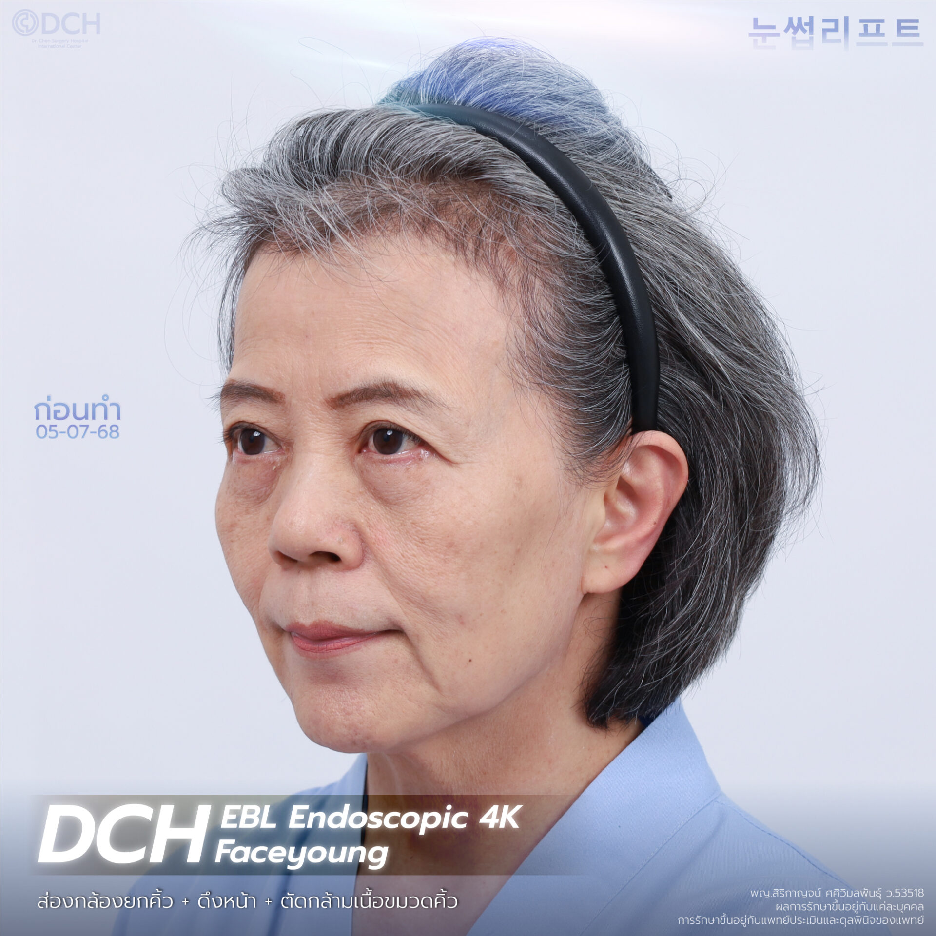 ดึงหน้า