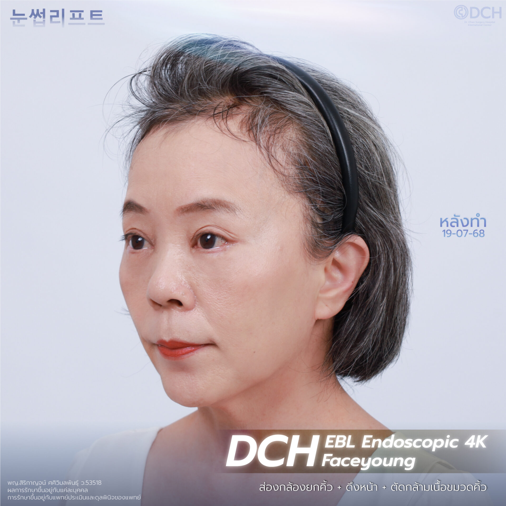 ดึงหน้า