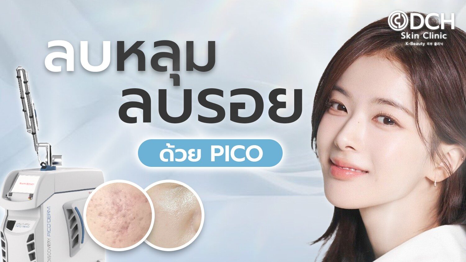 หลุมสิวและรอยสิว