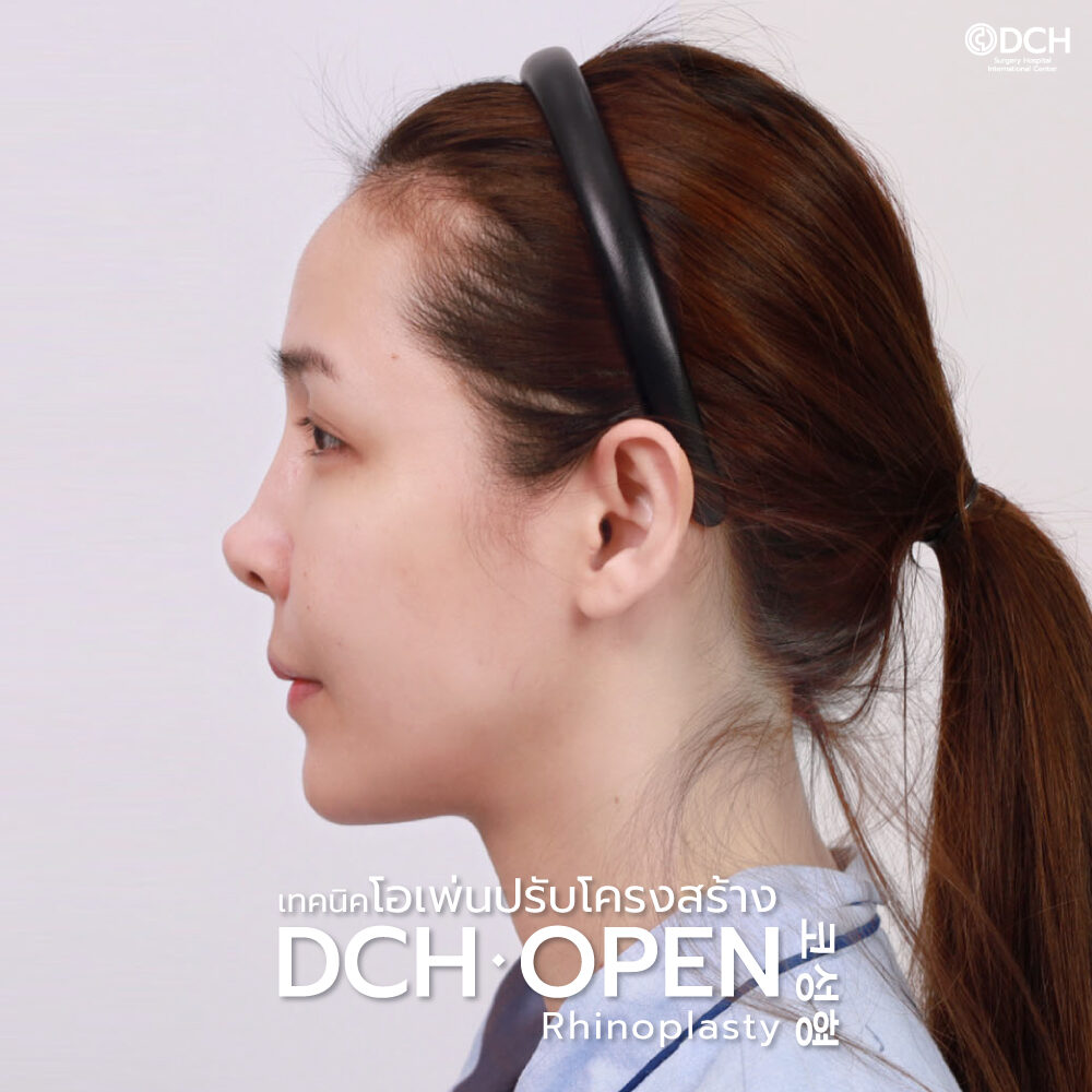 open-ก่อนทำ