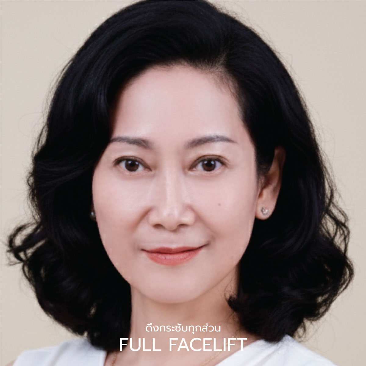 ดึงหน้า Full Facelift