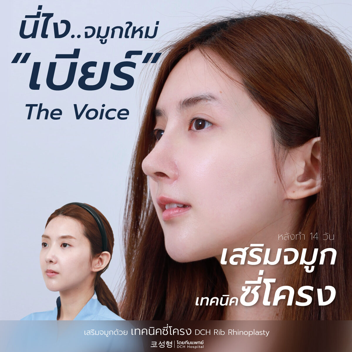 เสริมจมูก