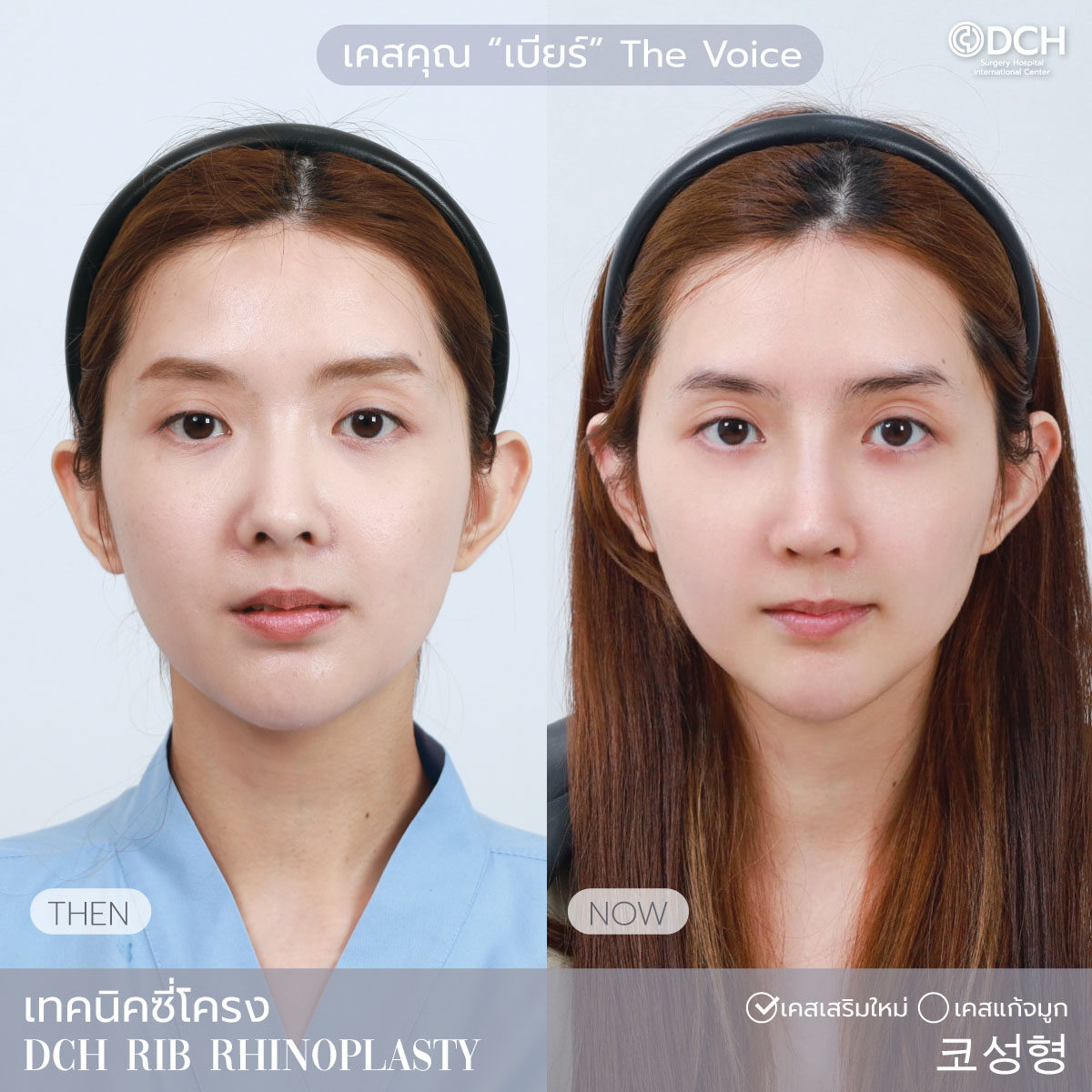 เบียร์ The Voice