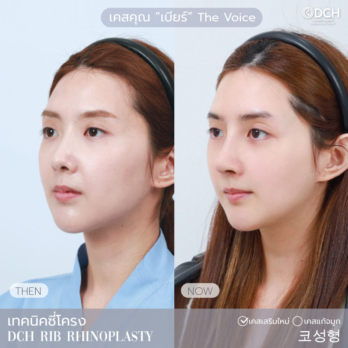 เบียร์ The Voice