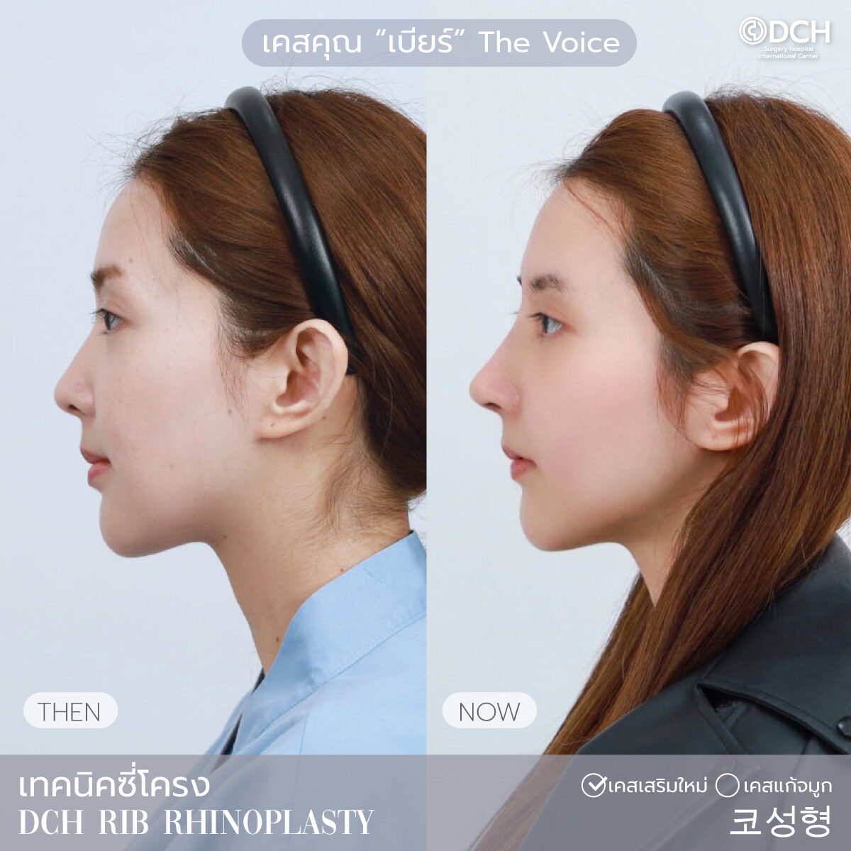 เบียร์ The Voice