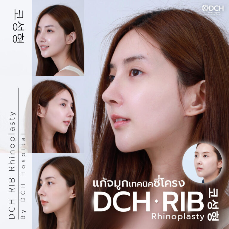 จมูกซี่โครง-เบียร์-เดอะวอยซ์etwe