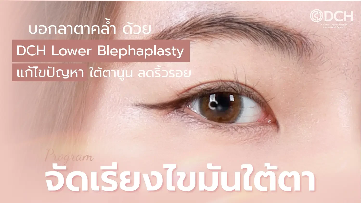 จัดเรียงไขมันใต้ตา
