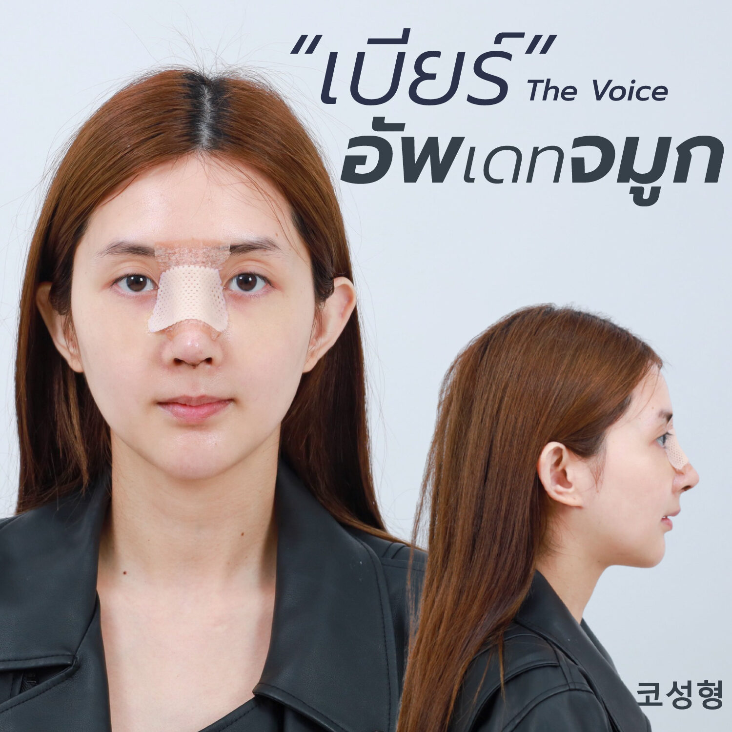 เสริมจมูก